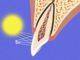omfarg3