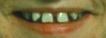 glesstallning_2_fore