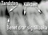 tdl7
